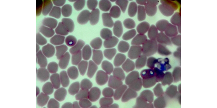 Babesiosis en los perros